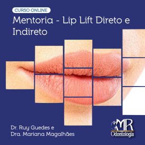 Curso Online de Lip Lift Direto e Indireto (Mentoria)