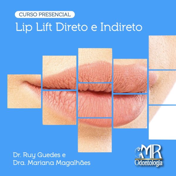 Curso de Lip Lift Direto e Indireto (Presencial)